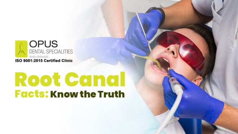 root canal myths vs. facts