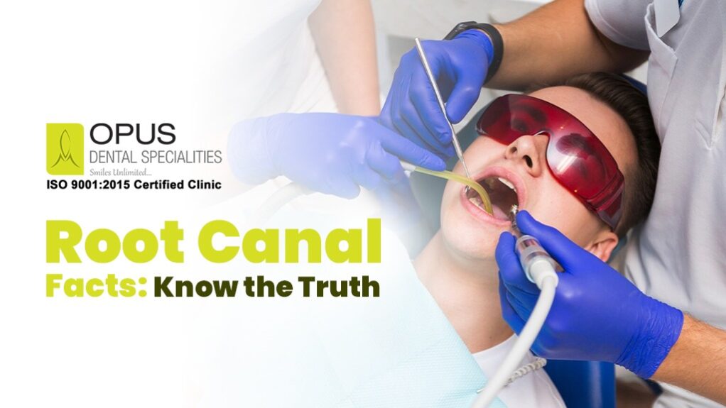 root canal myths vs. facts