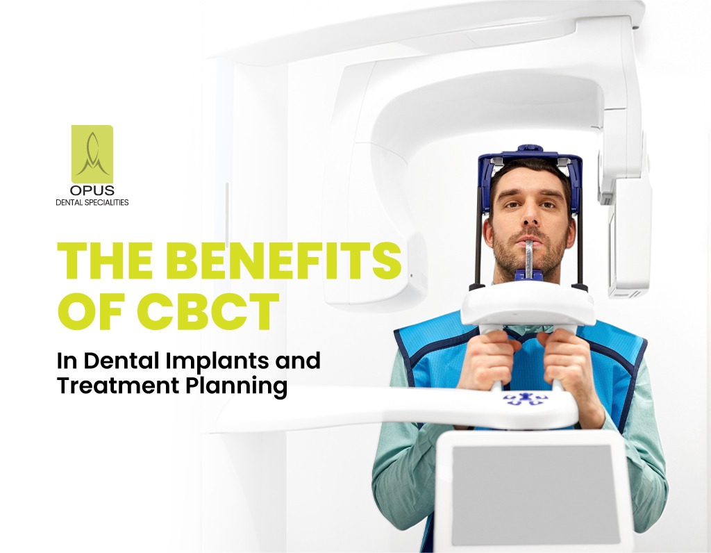 Benefits-of-CBCT