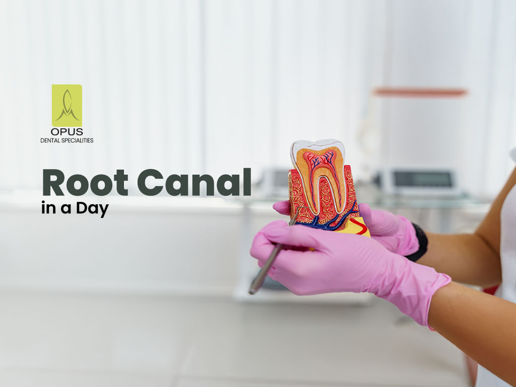 root canal in a day