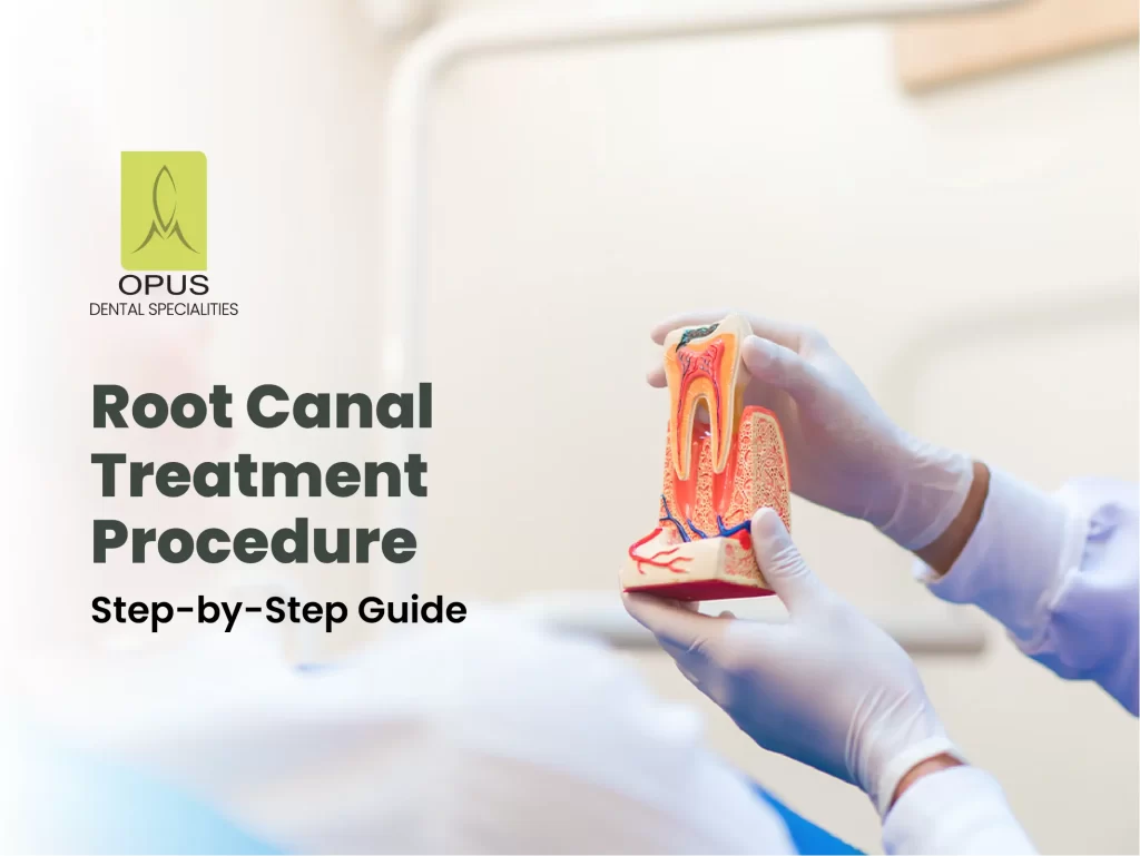 root canal treatment procedure step by step guide