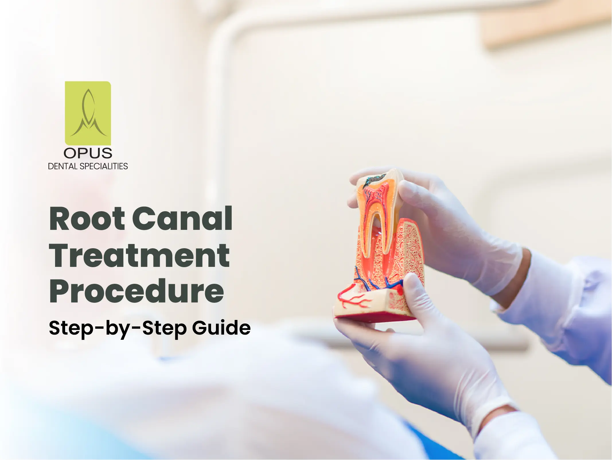 root canal treatment procedure step by step guide