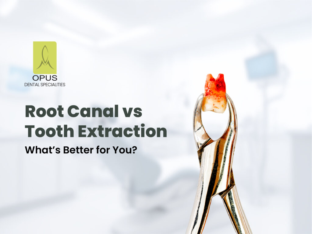 tooth extraction vs root canal