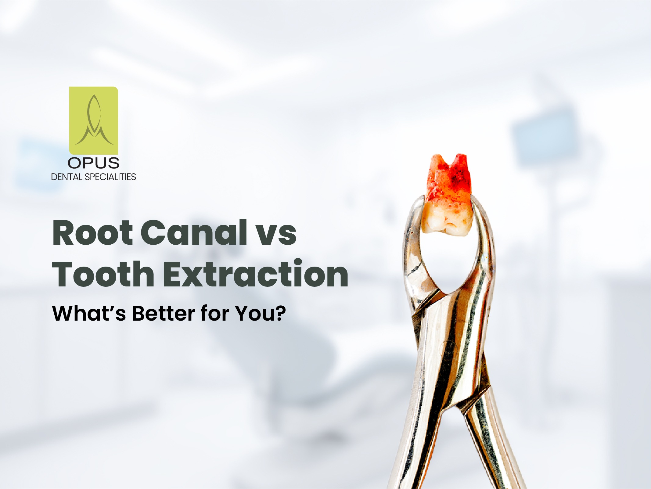 tooth extraction vs root canal